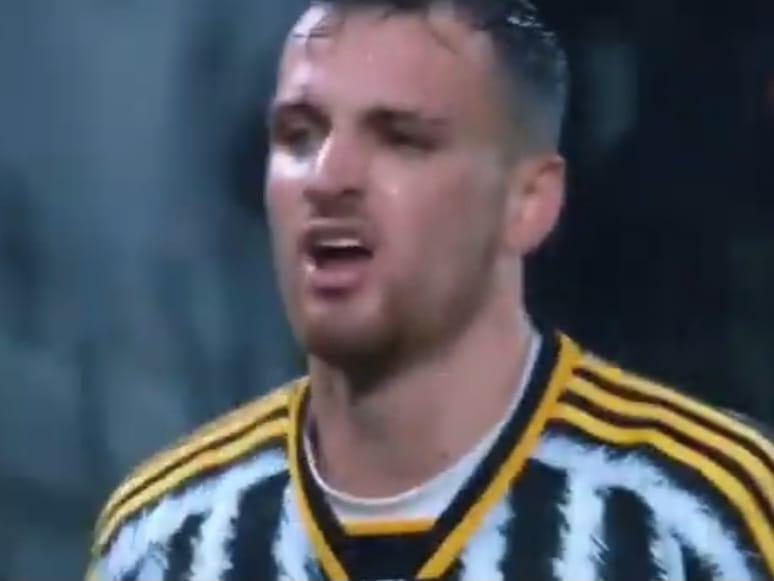 Juventus, Gatti out contro la Roma: frattura composta della diafisi del perone sinistro